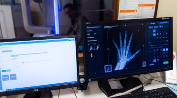 Monitor per RX mano