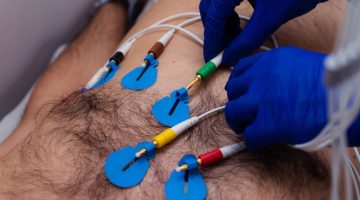 ECG CIDIMU