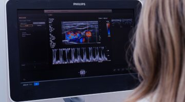 Ecocolordoppler