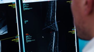 Risonanza magnetica della colonna