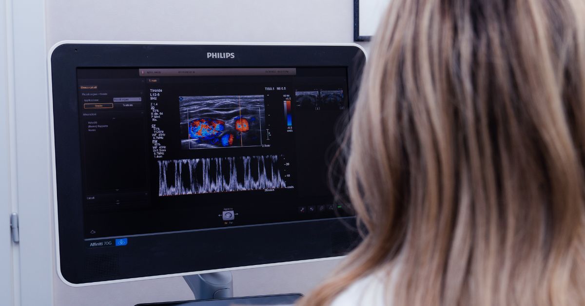 Ecocolordoppler insufficienza venosa