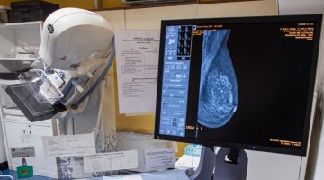 Mammografo